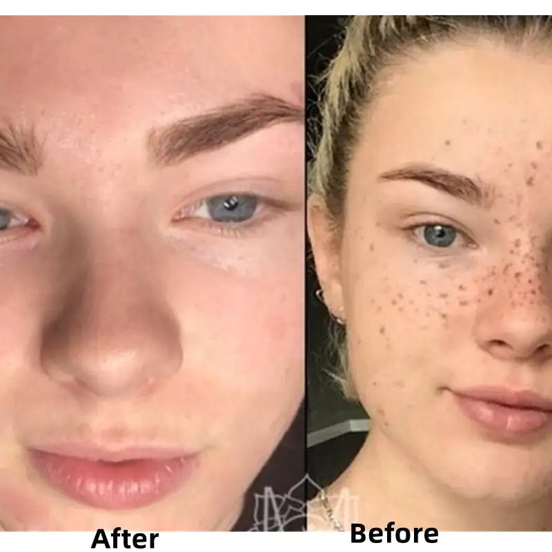 Turmeric Whitening Serum