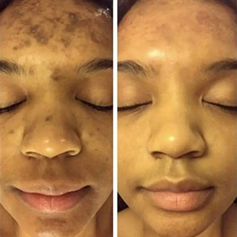 Turmeric Whitening Serum